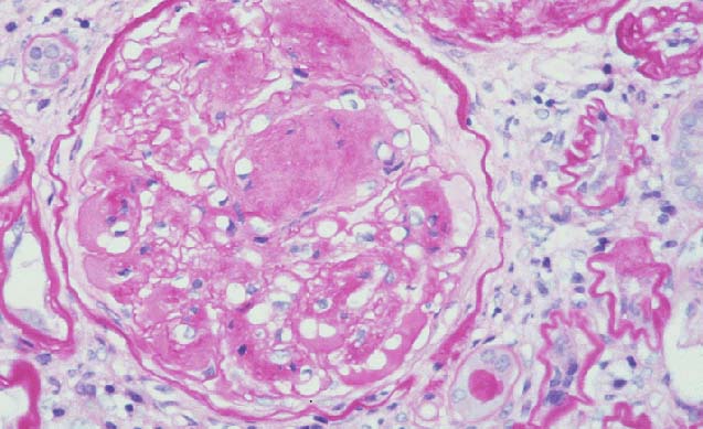 Overlap Fig A vs Fig B - Fig A Overlap Fig A vs Fig B - Fig A