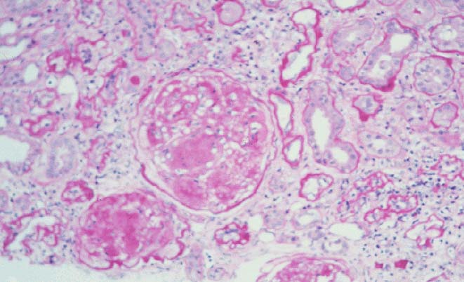 Overlap Fig A vs Fig B - Fig B Overlap Fig A vs Fig B - Fig B